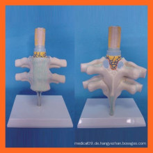 Vivid Human Cervical Vertebra, Spinal Nerv Anatomisches Modell